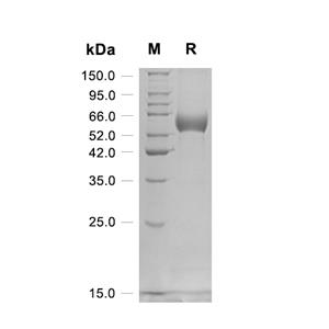 LBP蛋白, Human (HEK293, His),LBP Protein, Human (HEK293, His)