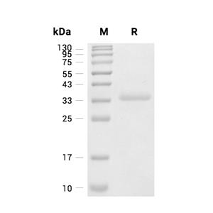IgG4 Fc蛋白, Human (HEK293)