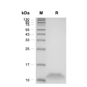 IL-8/CXCL8蛋白, Human (HEK293, His)