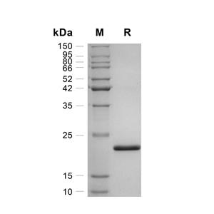 SHH蛋白, Human,SHH Protein, Human