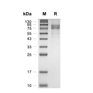 TPO/Thrombopoietin蛋白, Human (HEK293, C/N-His)