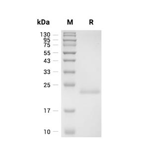 ESM-1蛋白, Mouse (HEK293, His)