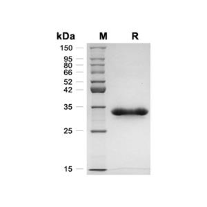 Erythropoietin receptor/EpoR蛋白, Human (HEK293, His)