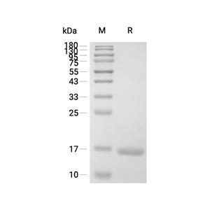 Lysozyme C/LYZ蛋白, Human (HEK293, His)