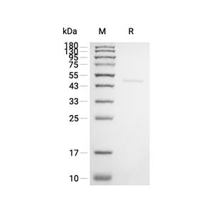 INPP5A蛋白, Human (HEK293, His)