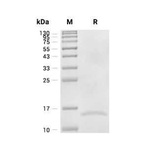 FABP4蛋白, Human (His)