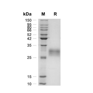Fc gamma RIIB/CD32b蛋白, Human (HEK293, His)