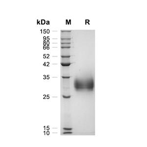 Fc gamma RIIA/CD32a蛋白, Human (HEK293, His)