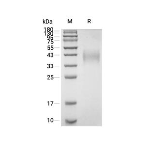 Fc gamma RIII/CD16蛋白, Mouse (HEK293, His)