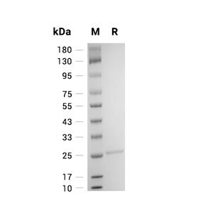 HSPB8蛋白, Human (His)