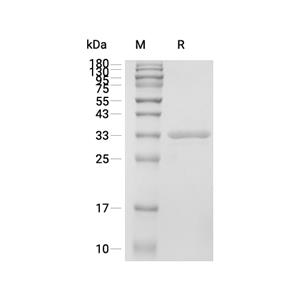 Syntenin-1蛋白, Human (C-His)