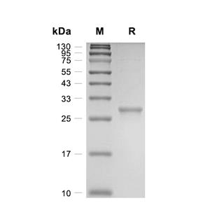 PP1MG蛋白, Human (His)