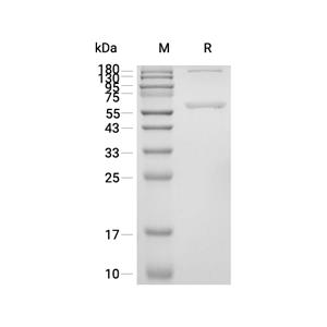 P4HB蛋白, Human (HEK293, His)