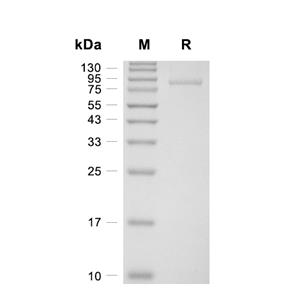 PFKM蛋白, Human (HEK293, His)