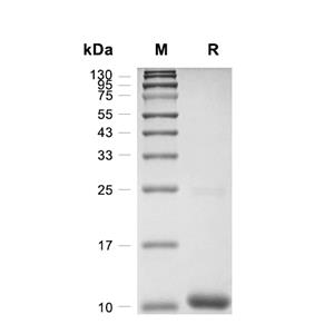 S100P蛋白, Human (His, solution)