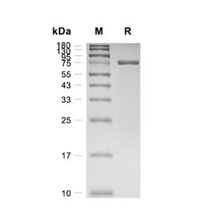 SLP-76蛋白, Human (His-T7)