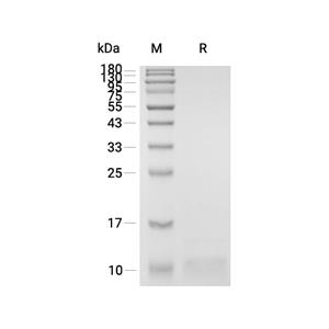 SPINK7蛋白, Human (HEK293, His)