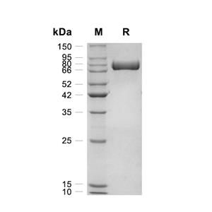 Transferrin蛋白, Human (HEK293, His),Transferrin Protein, Human (HEK293, His)