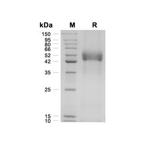 AHSG/Fetuin-A蛋白, Mouse (HEK293, His)