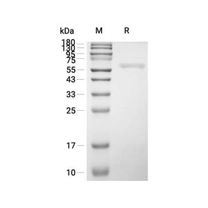 Galectin-9/LGALS9蛋白, Human (GST),Galectin-9/LGALS9 Protein, Human (GST)