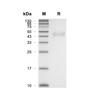 Galectin-9/LGALS9蛋白, Human (HEK293, His)