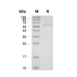 TNFRSF11B/OPG蛋白, Mouse (HEK293, His)