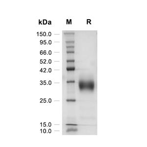 SOST蛋白, Mouse (HEK293, His),SOST Protein, Mouse (HEK293, His)