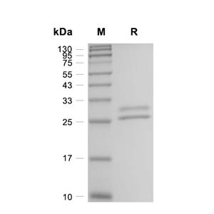 Prolactin蛋白, Sheep (HEK293, His)