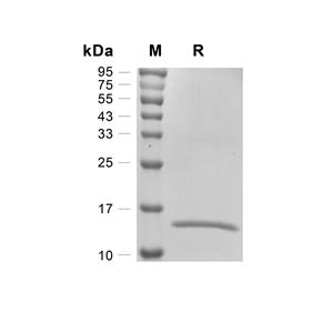 Galectin-7/LGALS7蛋白, Human