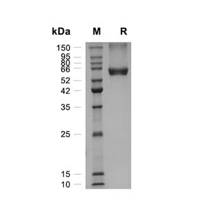 Ephrin-B1/EFNB1蛋白, Mouse (HEK293, Fc-His),Ephrin-B1/EFNB1 Protein, Mouse (HEK293, Fc-His)
