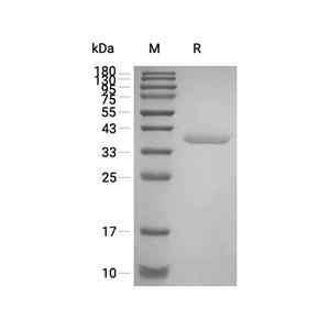 MDH1蛋白, Human (His)