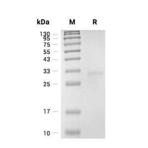 TRAT1蛋白, Human (His)