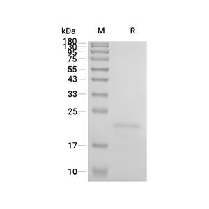 ZBP1蛋白, Human (His)