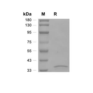 ETS1/EWSR2蛋白, Human (His)