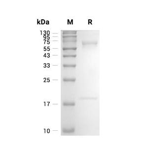 PCSK9蛋白, Macaca nemestrina (HEK293, His)