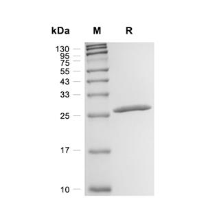 UCHL1蛋白, Human (His, solution)