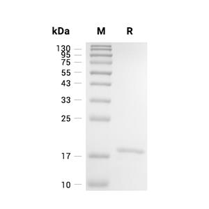 Tau-D/0N4R蛋白, Human (133a.a, His),Tau-D/0N4R Protein, Human (133a.a, His)