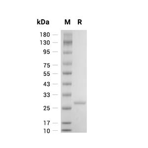 UCHL3蛋白, Human (His)