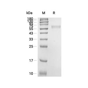Serpin A3N蛋白, Mouse (HEK293, His)