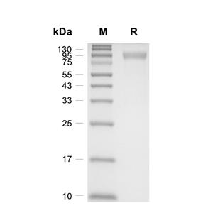 Siglec-E蛋白, Mouse (HEK293, Fc),Siglec-E Protein, Mouse (HEK293, Fc)