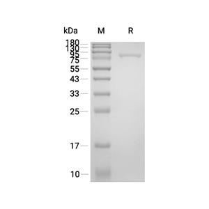 THOP1蛋白, Human (His),THOP1 Protein, Human (His)