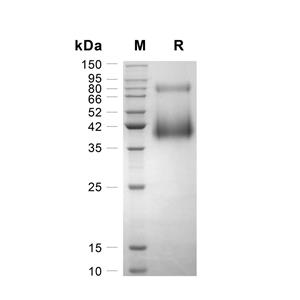 Granzyme D/GZMD蛋白, Mouse (HEK293, His),Granzyme D/GZMD Protein, Mouse (HEK293, His)
