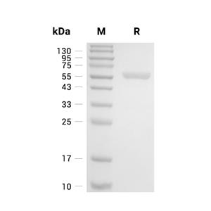Importin alpha-1/KPNA2蛋白, Human (His)