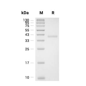 UDP-glucose 4-epimerase/GALE蛋白, Human (His)