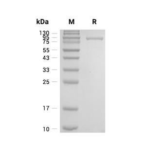 KPNB1蛋白, Human (His)