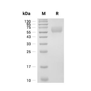 HYOU1蛋白, Human (HEK293, His),HYOU1 Protein, Human (HEK293, His)