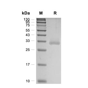 Kallikrein-4蛋白, Human (H197Q, HEK293, His)