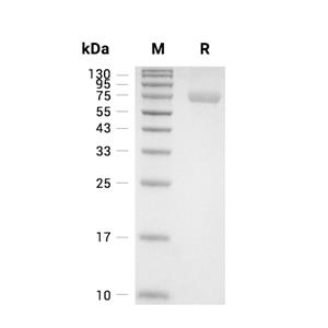 TPP1蛋白, Human (HEK293, His)