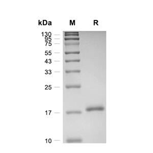 TAC1蛋白, Human (His)