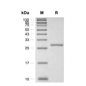 PRDX6蛋白, Human (His)
